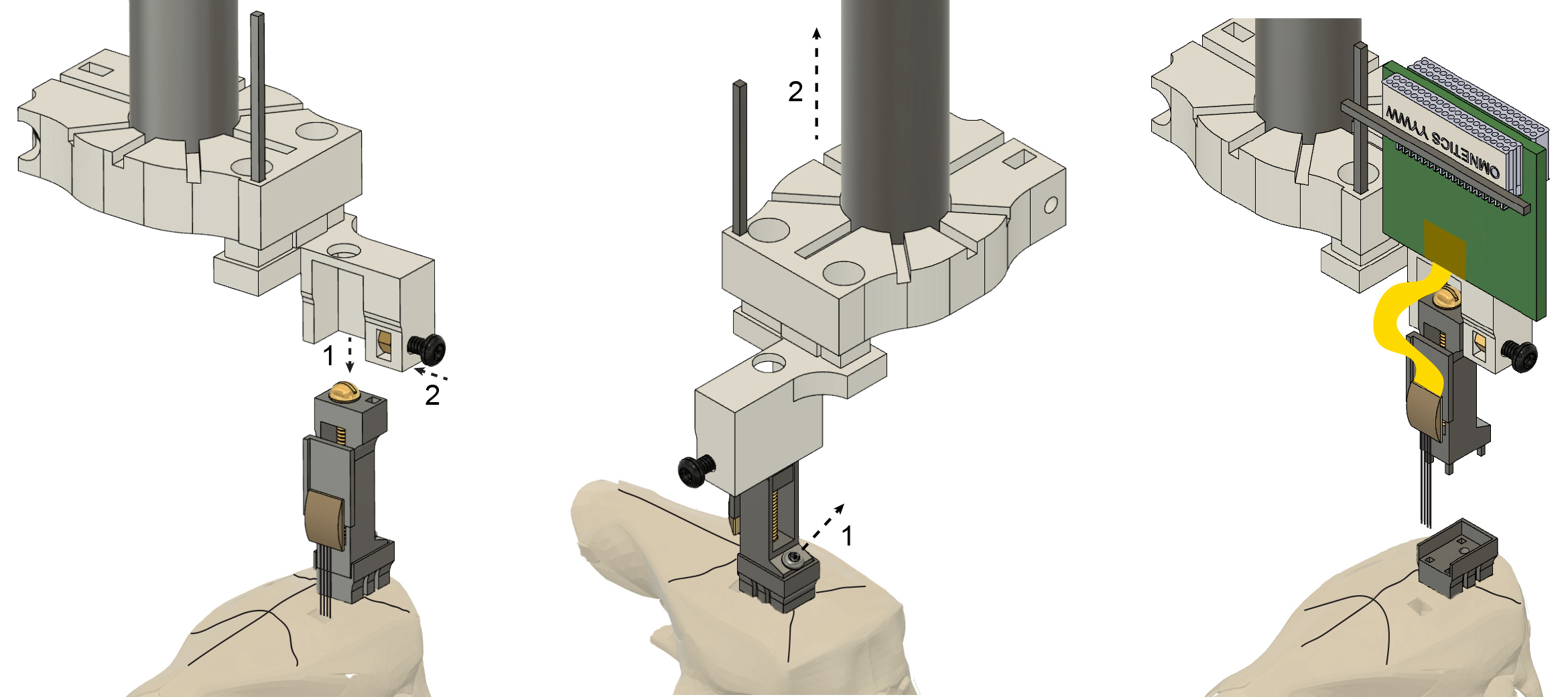 Recoverable microdrive